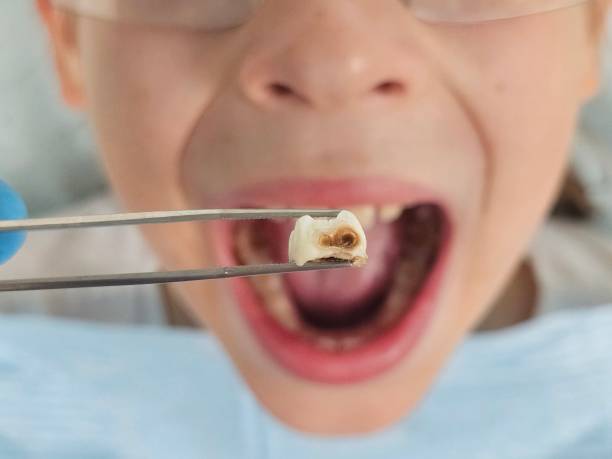 Best Tooth Pain Emergency Relief  in Hannahs Mill, GA